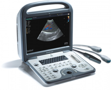 mobile ultrasound